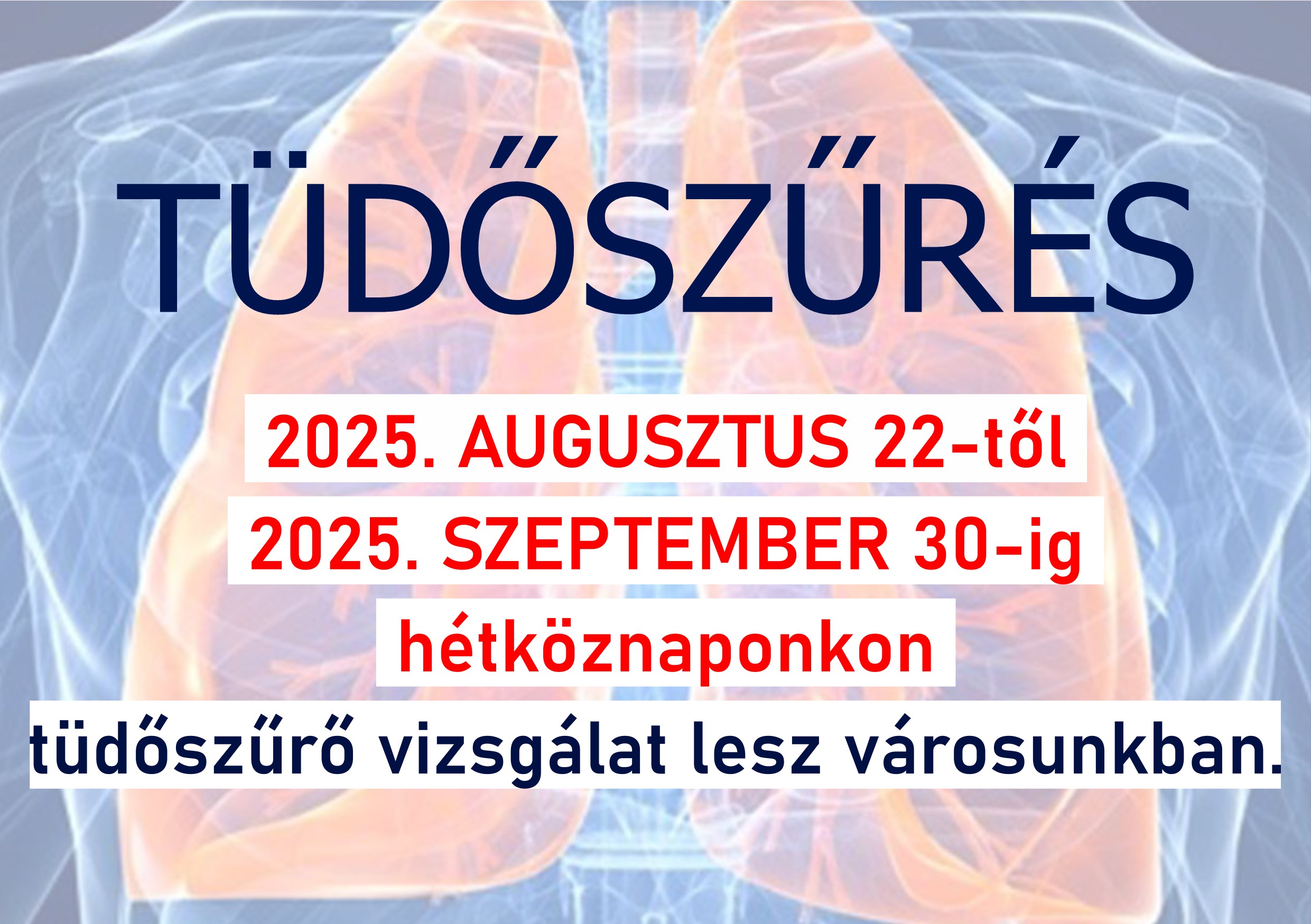Tisztelt Lakosság! Hamarosan kezdődik a tüdőszűrés Szigetszentmiklóson!